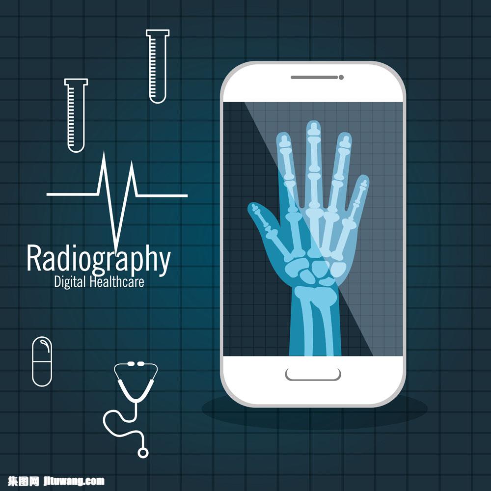 手机里的手掌x光片图片